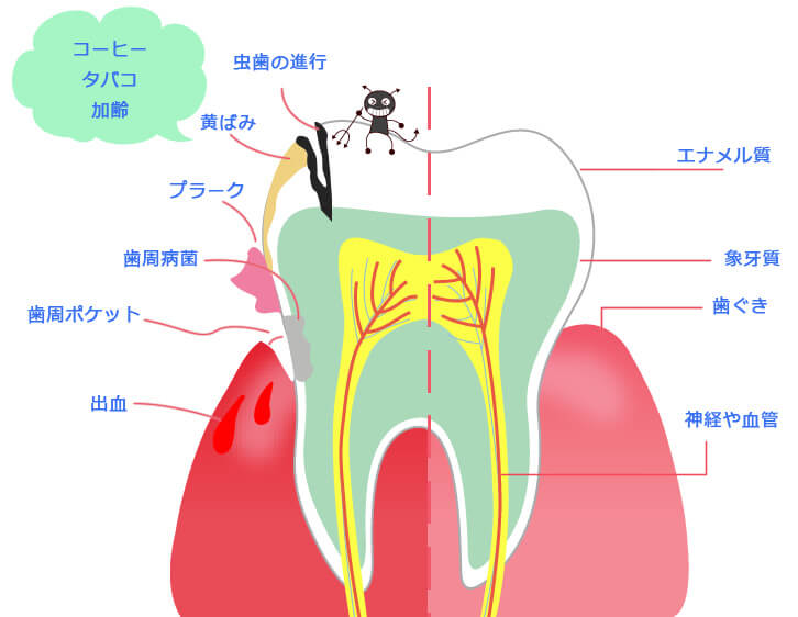 働き盛りのあなたのお口は大丈夫？～年齢とともに増加するリスク～